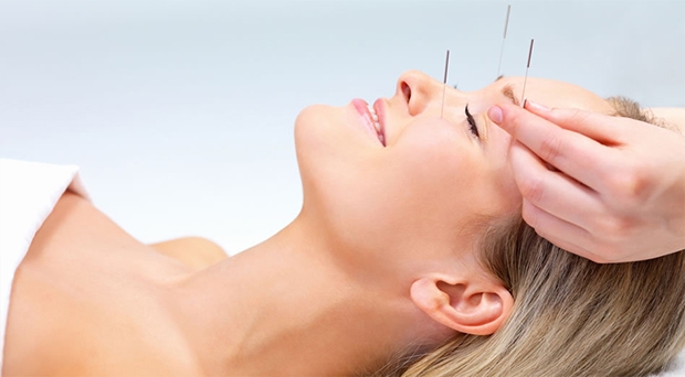 Acupuncture - Alternative Medicine