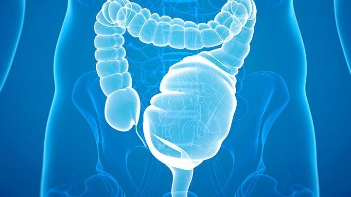 Megacolon السامة - الأسباب والأعراض والتشخيص