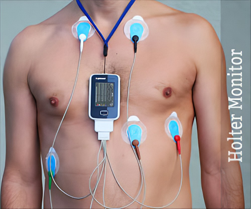 Holter Monitor - Everything You Need To Know