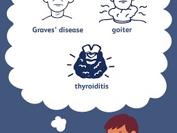 Hyperthyroidism: Causes, Symptoms, Treatment & Medication