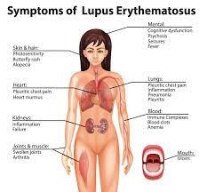 Lupus - Symptome, Diagnosen und Ursachen