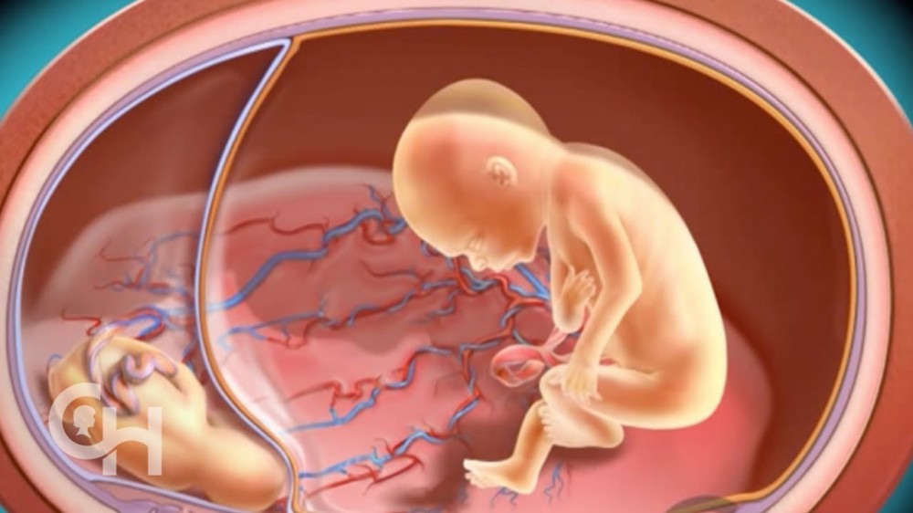 Selective Intrauterine Growth Restriction - Maximed Turkey