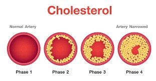 Why Cholesterol Matters for Women - Maximed Turkey