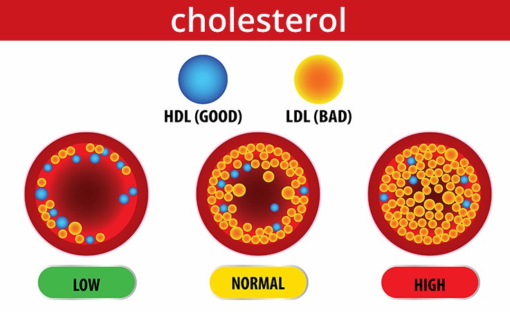 Высокий холестерин - все, что вам нужно знать - Maximed Турция