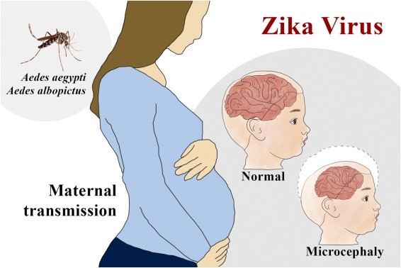 Zika-Virus – Ursprung, Symptome, Verbreitung und Behandlung