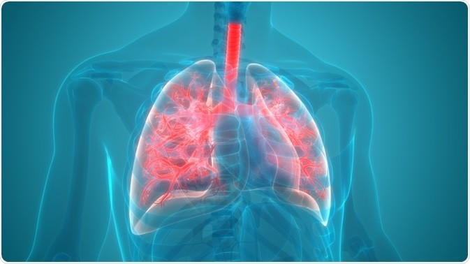 Pneumonia - Causes, Prevention and Treatment