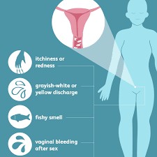 Bakterielle Vaginose – Ursachen und Behandlung