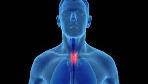 Esophageal Cancer - Symptoms, Causes and Treatments