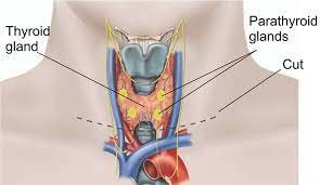 Parathyroidectomy Procedure - Maximed Turkey